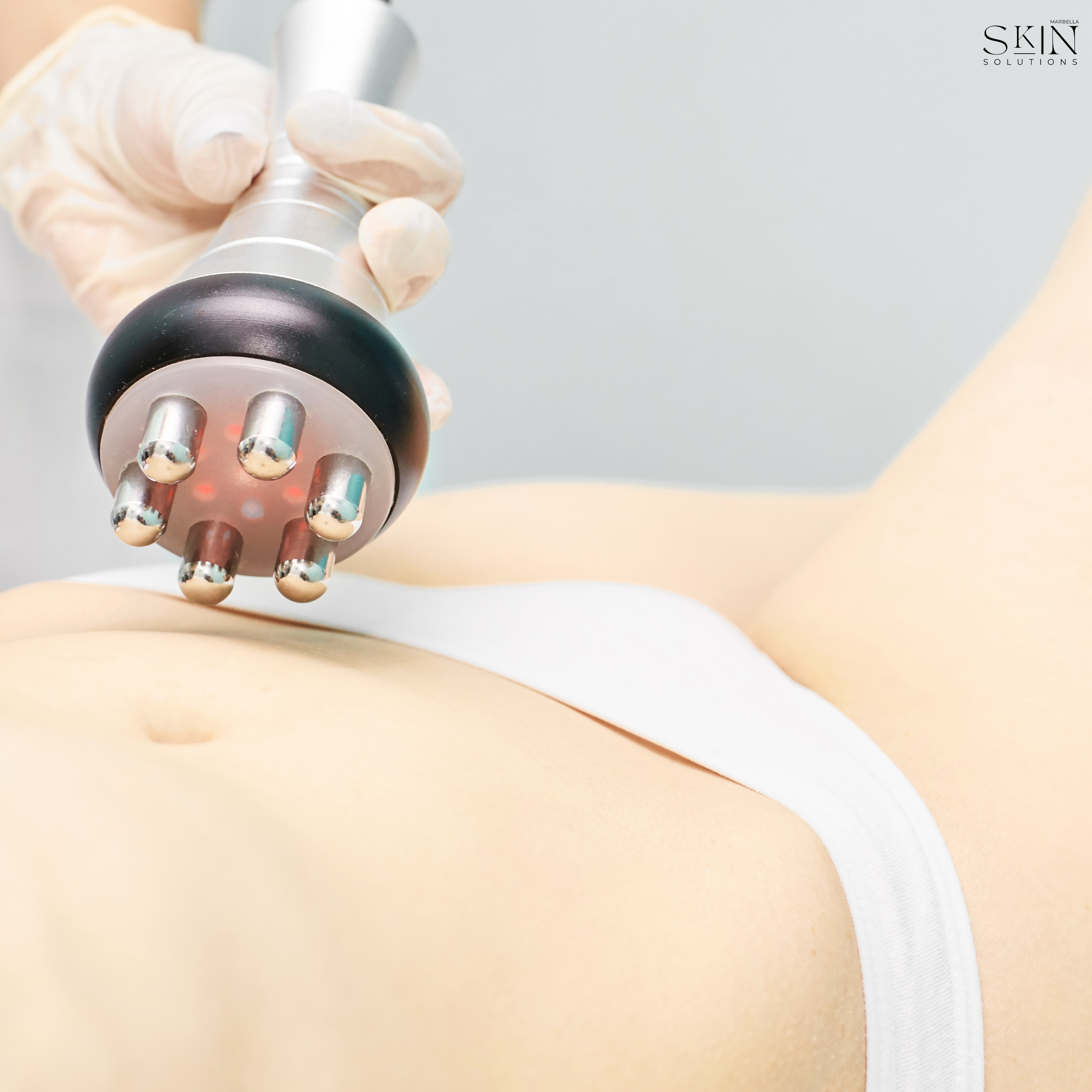 Advanced radiofrequency body contouring for firming sagging skin and reducing fat