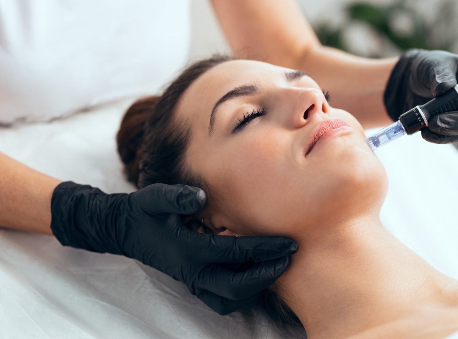 Woman receiving advanced facial treatment with exosomes and fractional radiofrequency at Skin Solutions Marbella